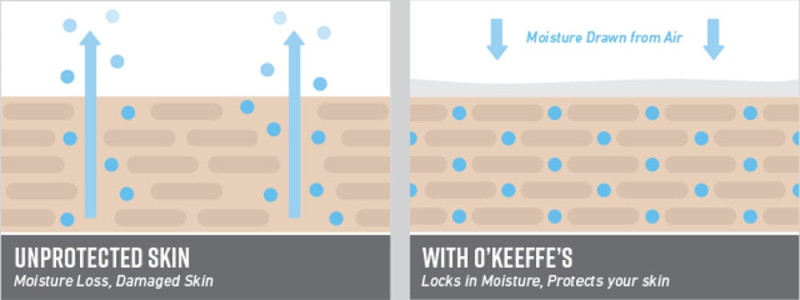 Hvorfor O'Keeffe's creme virker